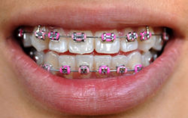 Orthodontie